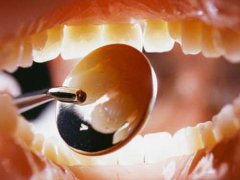 Послуги стоматолога вдома на Буковині закінчились скандалом