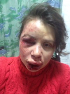 Журналістку та активістку Євромайдану Тетяну Чорновіл жорстоко побили