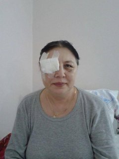 Побита "Беркутом" жінка не бачить правим оком: їй потрібно імплантувати штучний хрусталик