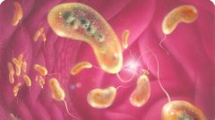 Чернівецька СЕС попереджає про можливі ризики зараження на холеру